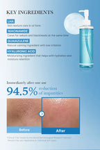Medicube - Zero Pore Blackhead Deep Cleansing Oil, 205ml